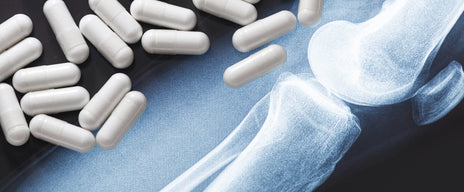 How to Take Glucosamine for Joint Pain Relief — Dosage, Timing, and Best Combinations