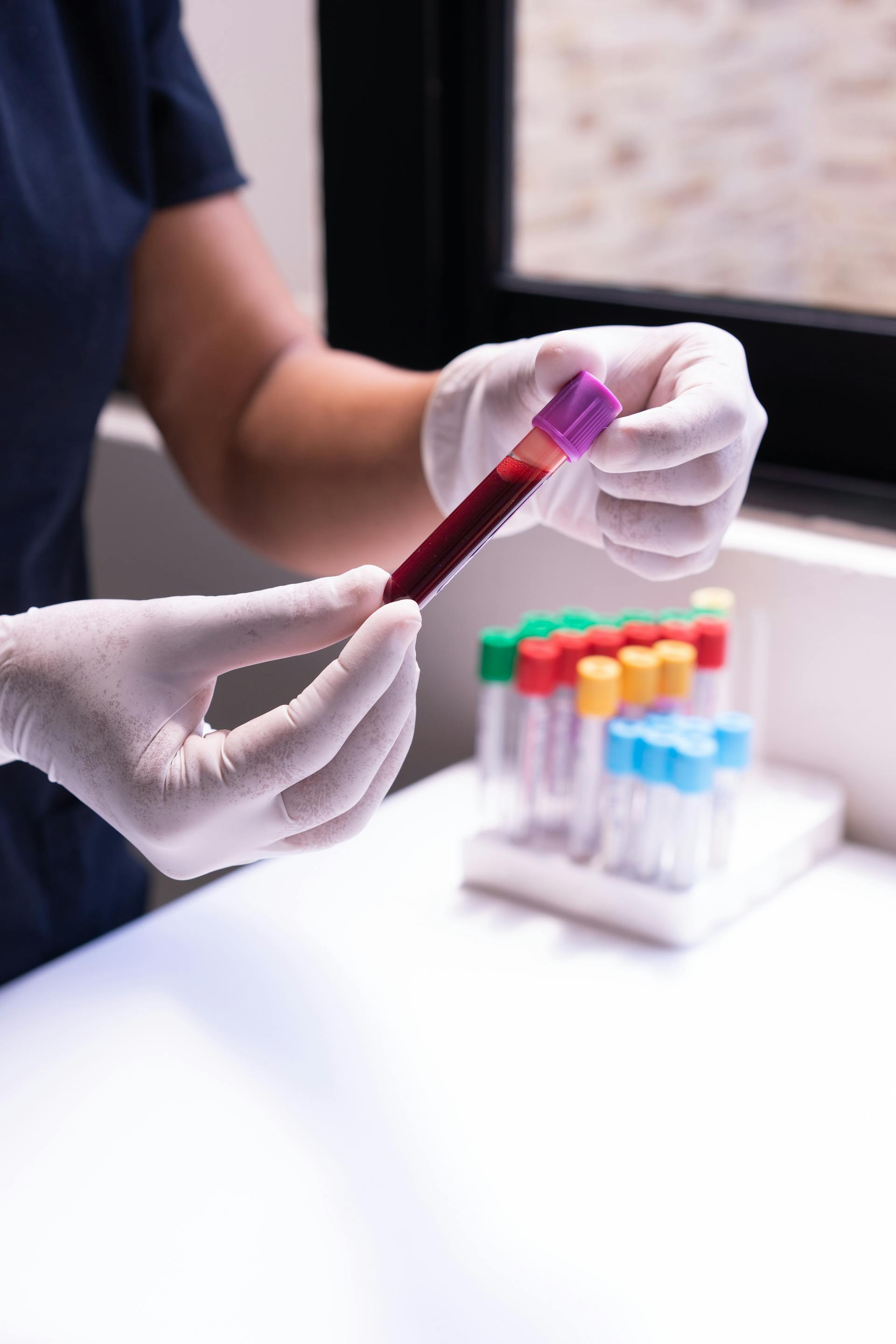 Blood tests for Perimenopause and Menopause