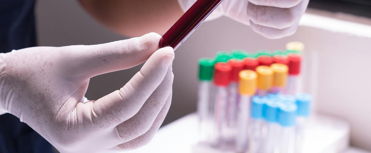 Blood tests for Perimenopause and Menopause